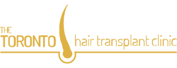 TorontoHairTransplant