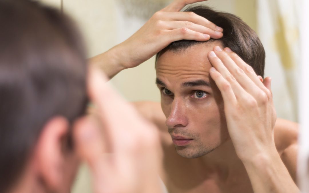 Spring Hair Loss Checkup for Toronto Men: When to See a Clinic
