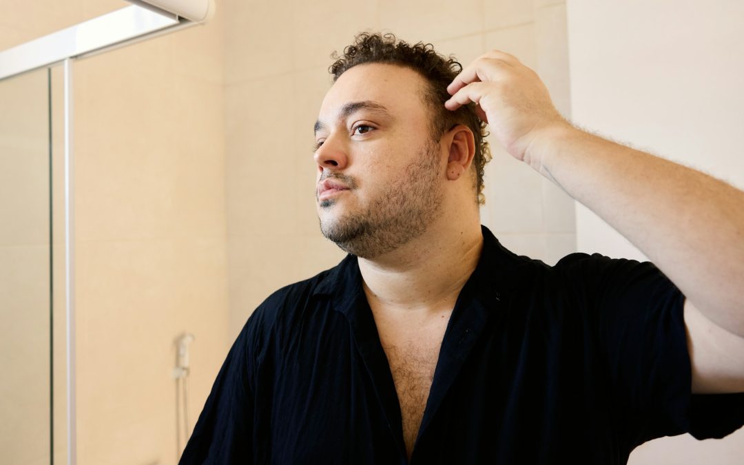 Questioning Hair Loss Treatments Toronto Men See Online